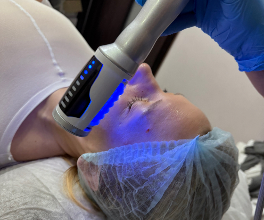 Эндосфера по лицу    терапия лица - современный метод по уходу за лицом, шеей, декольте, направленный на омоложение, поднятие тонуса, запуск естествен