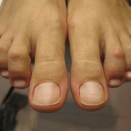 Мужской педикюр