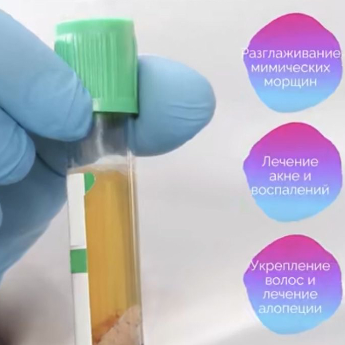 Плазмотерапия