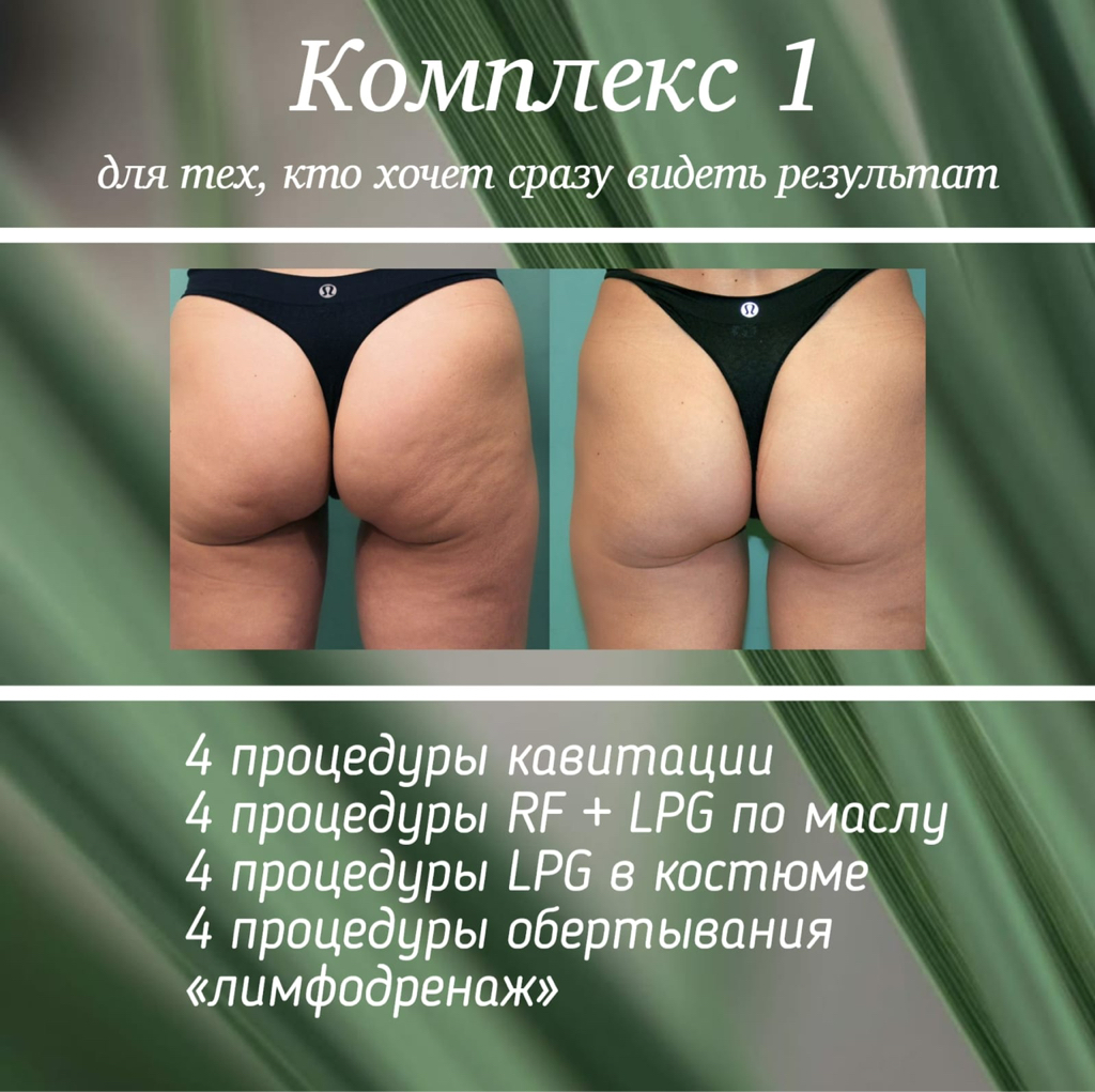 Комплекс по телу N1