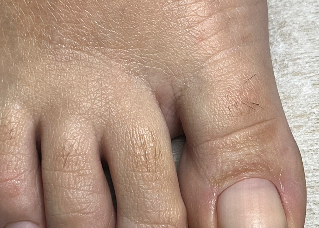 Препаратно-аппаратный педикюр 1 категории