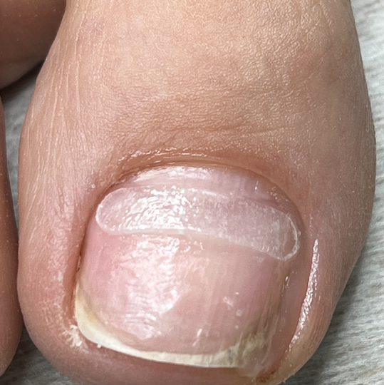 Установка коррекционной системы Лайт Систем