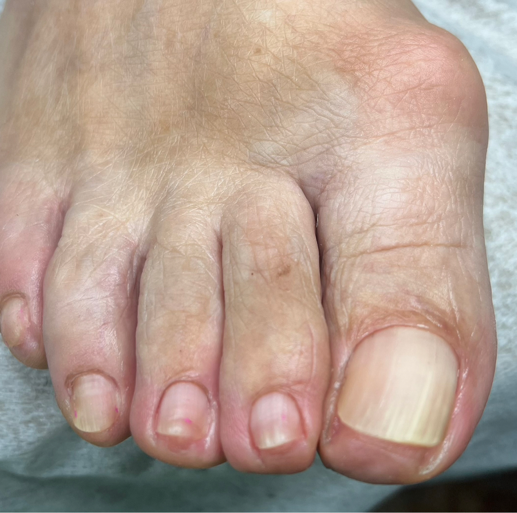 Препаратно-аппаратный педикюр 2 категории