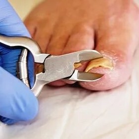 Стрижка сложных ногтей