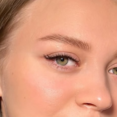 LED наращивание уголков