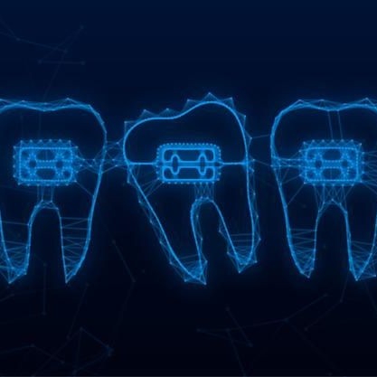 Активация брекет-системы установленной в другой клинике