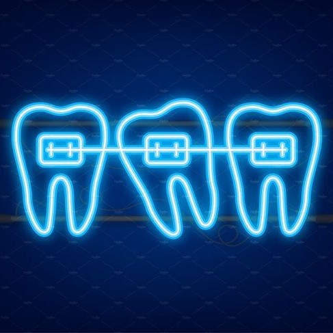 Фиксация брекет-системы