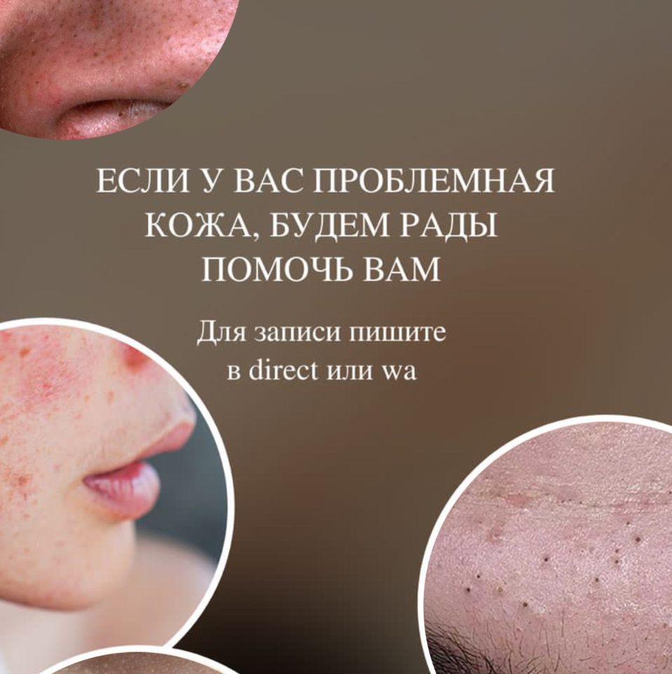 Комплексная чистка лица