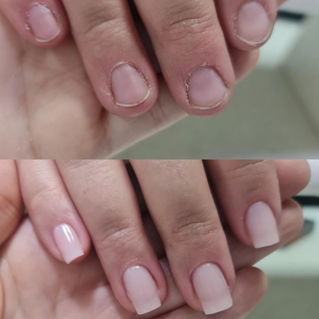 Наращ-ние ногтей Короткие (Верхние Формы)