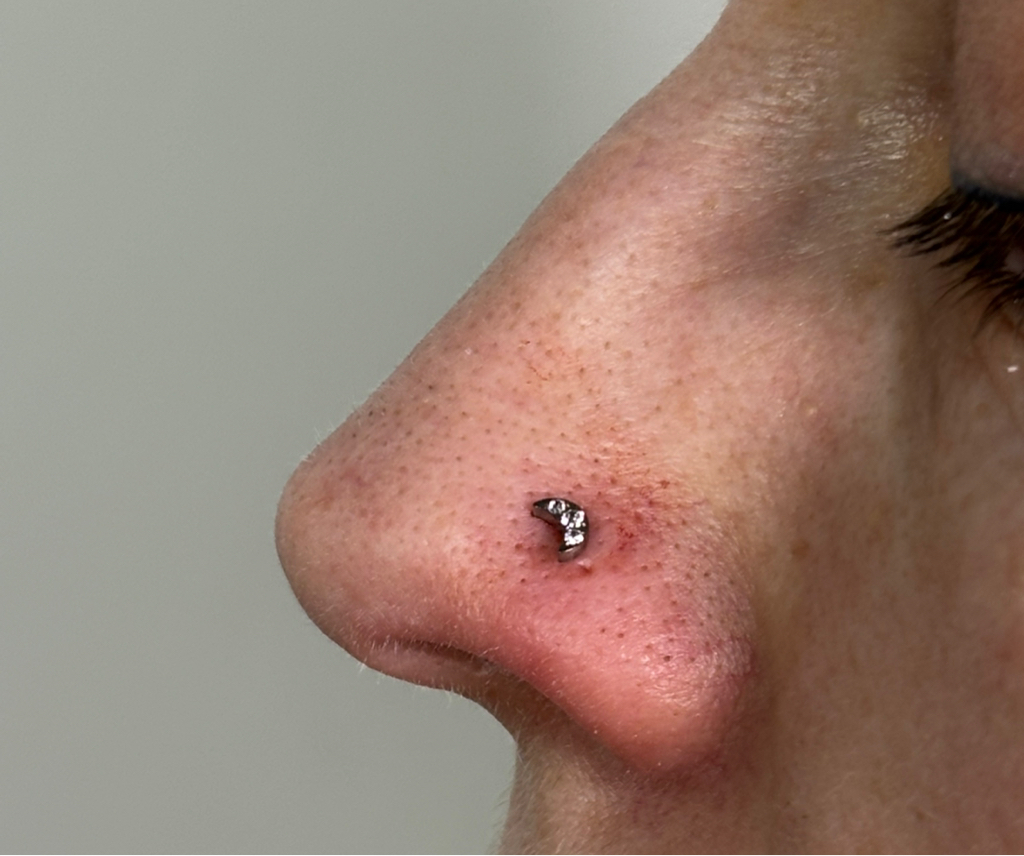 Прокол крыло носа