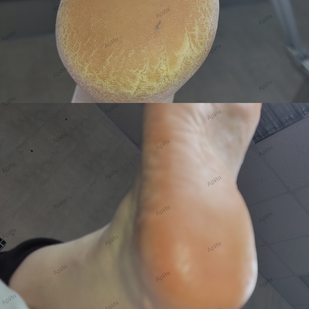 Комплекс 