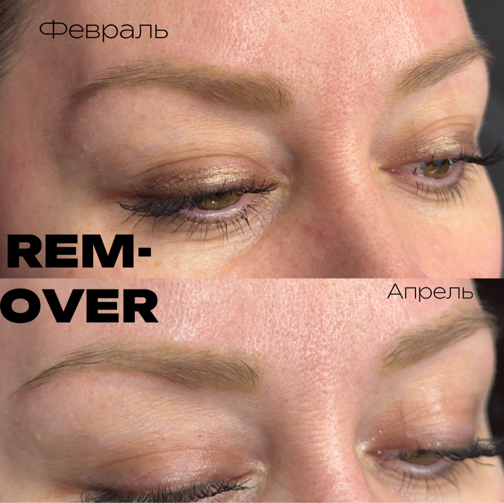 Удаление перманента ремувером