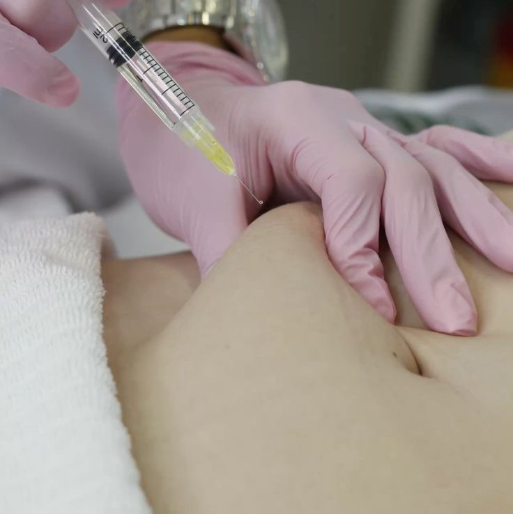 «Худое»лицо