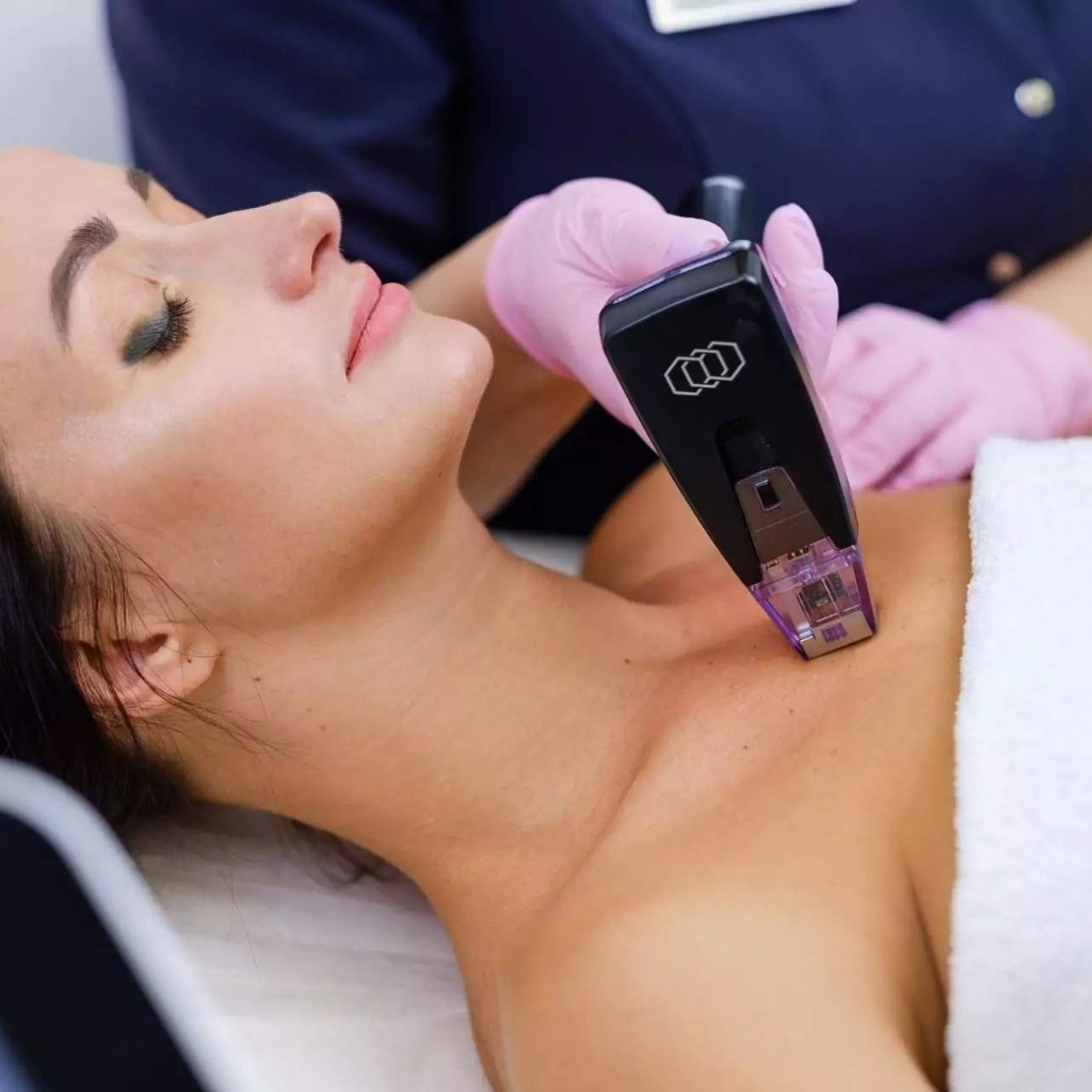 RF- ЛИФТИНГ "Всё включено" игольчатый (лицо, область век, шея, декольте, кисти рук)