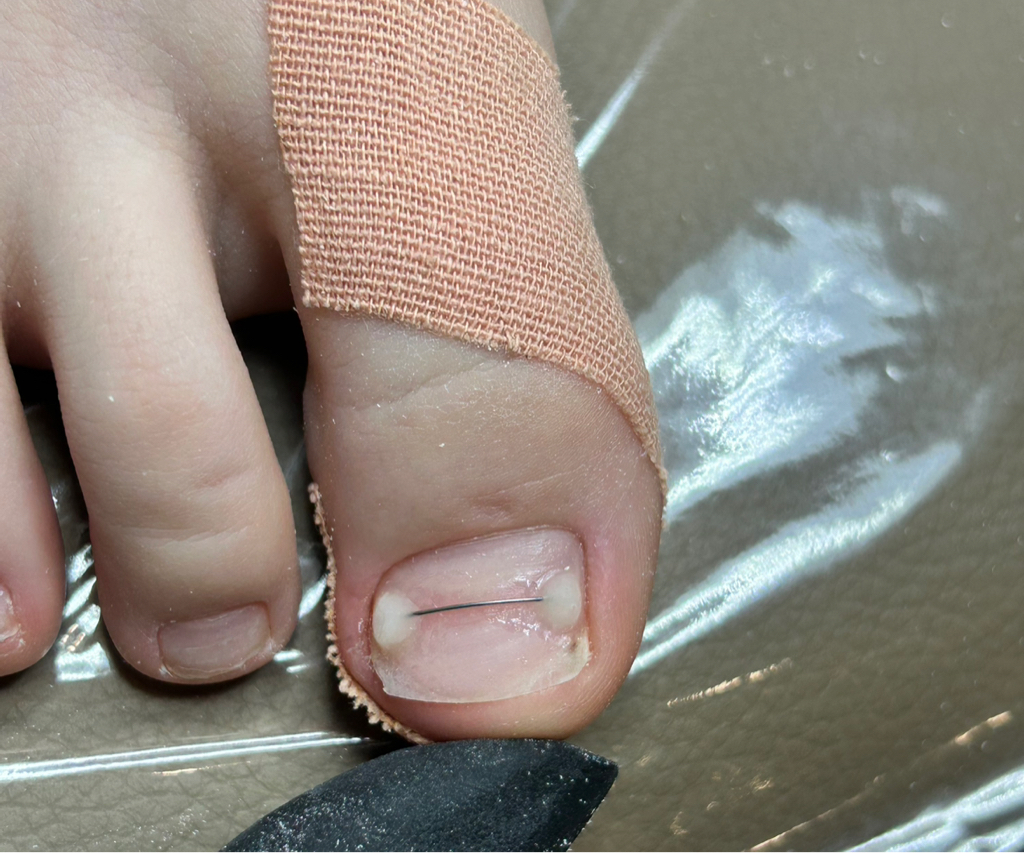 Установка коррекционной системы