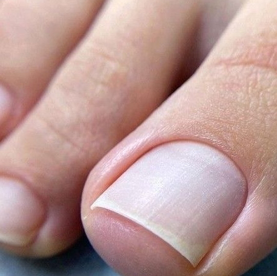 Обработка ногтей на ногах