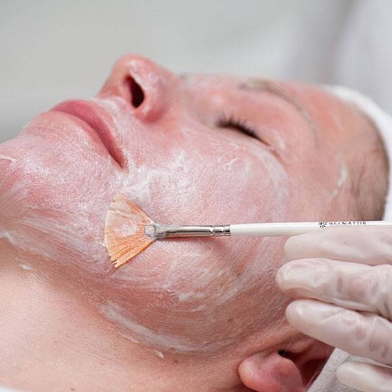 Пилинг поверхностный