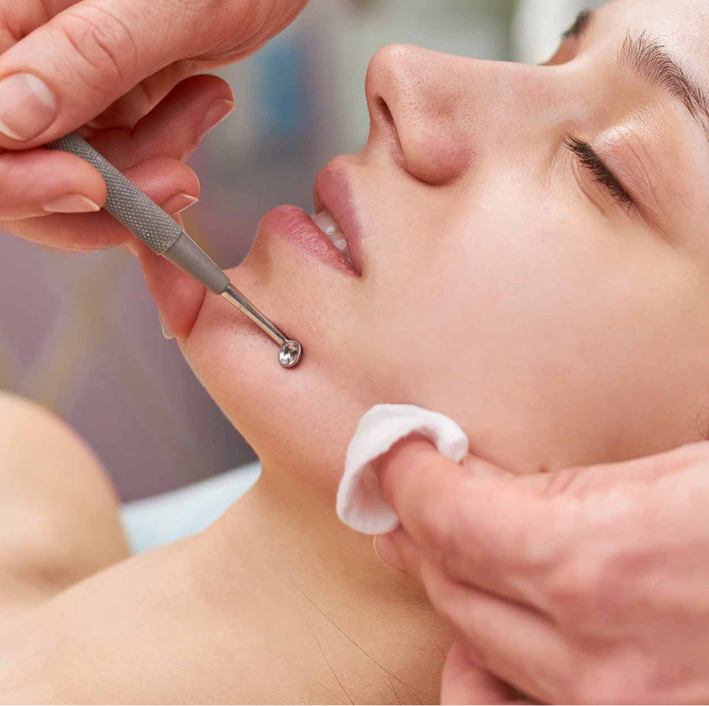 Чистка лица