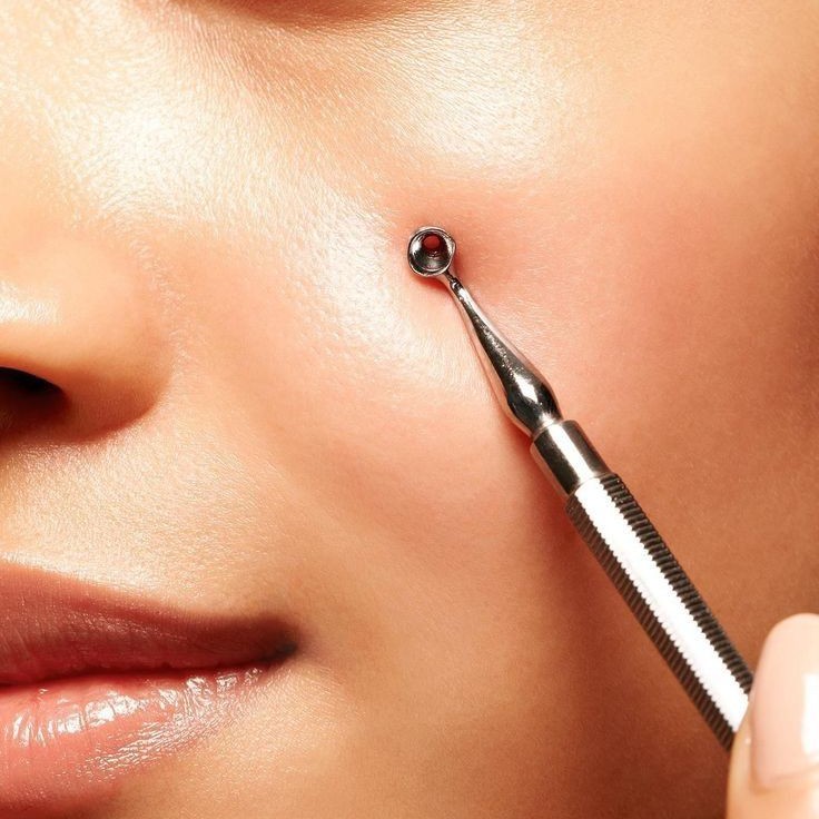 Механическая чистка лица