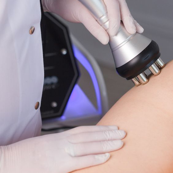 Рф лифтинг тела (1 зона) Абонемент на 5 посещений