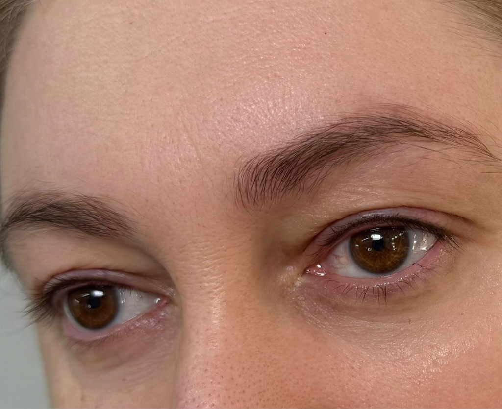 Межресничный контур