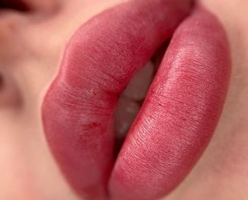 Перманентный макияж губ+Биоревитализация