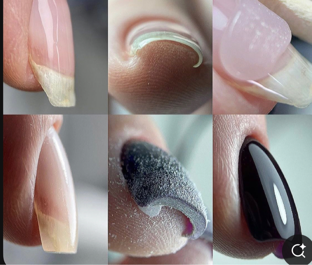 Коррекция ногтей