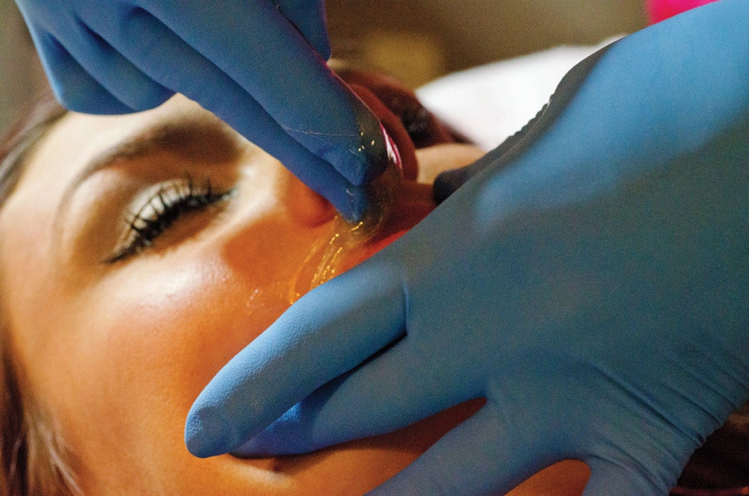 Депиляция верхней губы