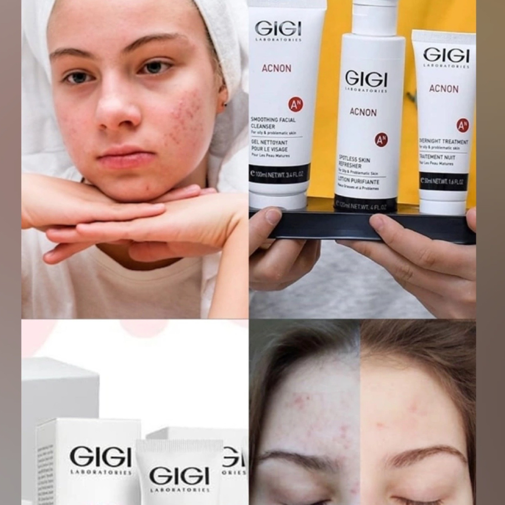 Консультация