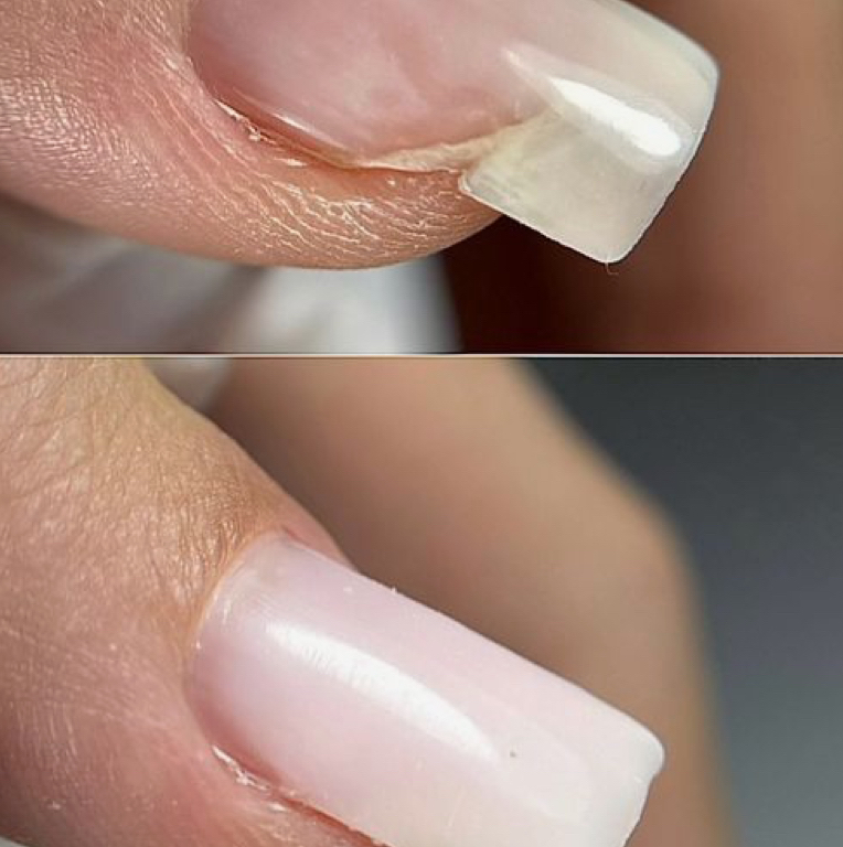 ремонт ногтя