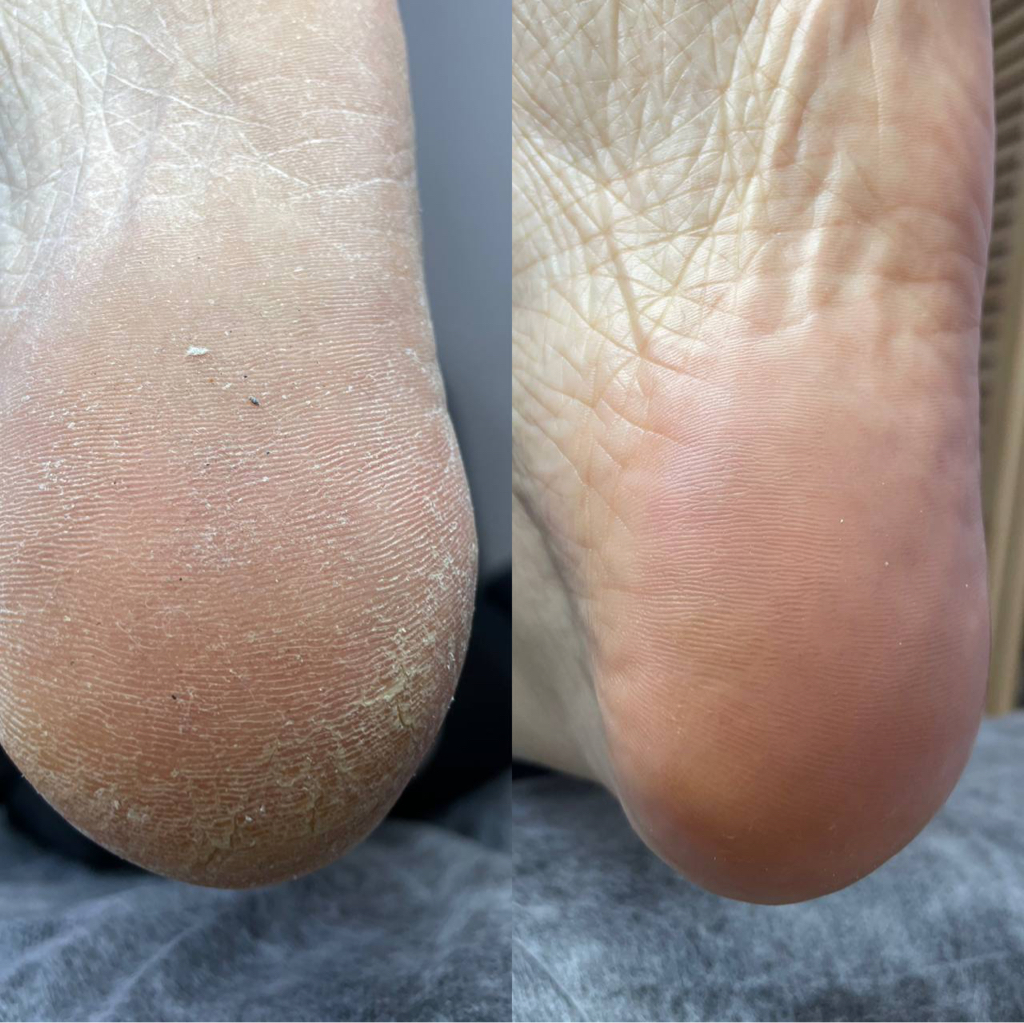 Обработка пальчиков + стопы + покрытие