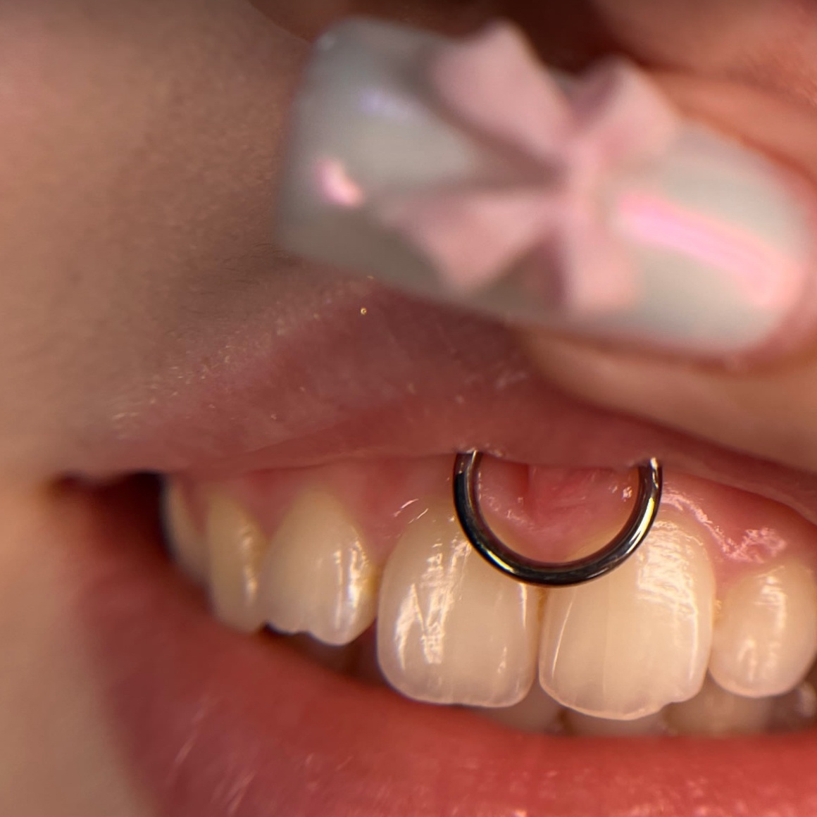 Замена украшения