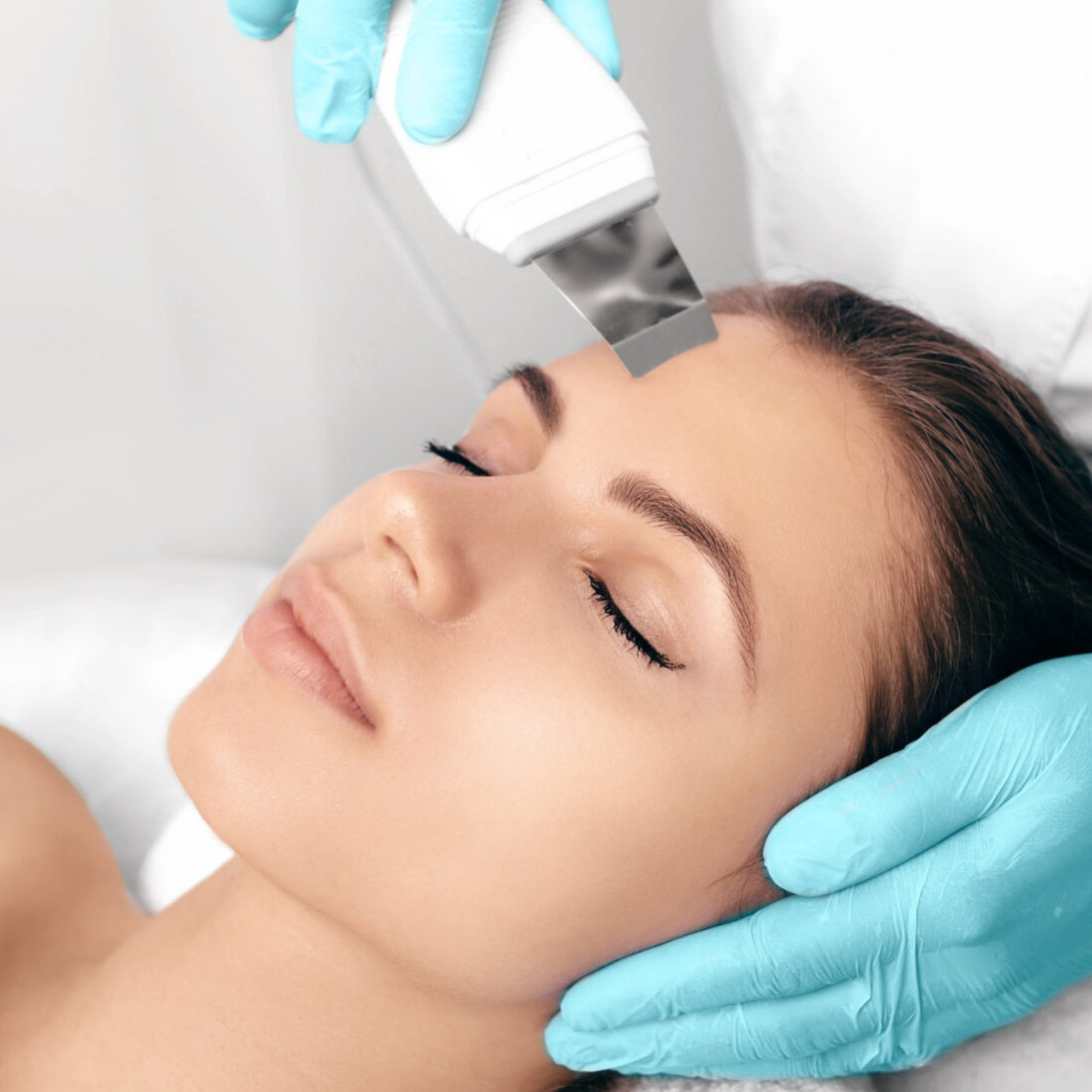 УЗ- ЧИСТКА +ПОВЕРХНОСТНЫЙ ПИЛИНГ (ЛЕГКИЙ) ПО ПРОБЛЕМЕ