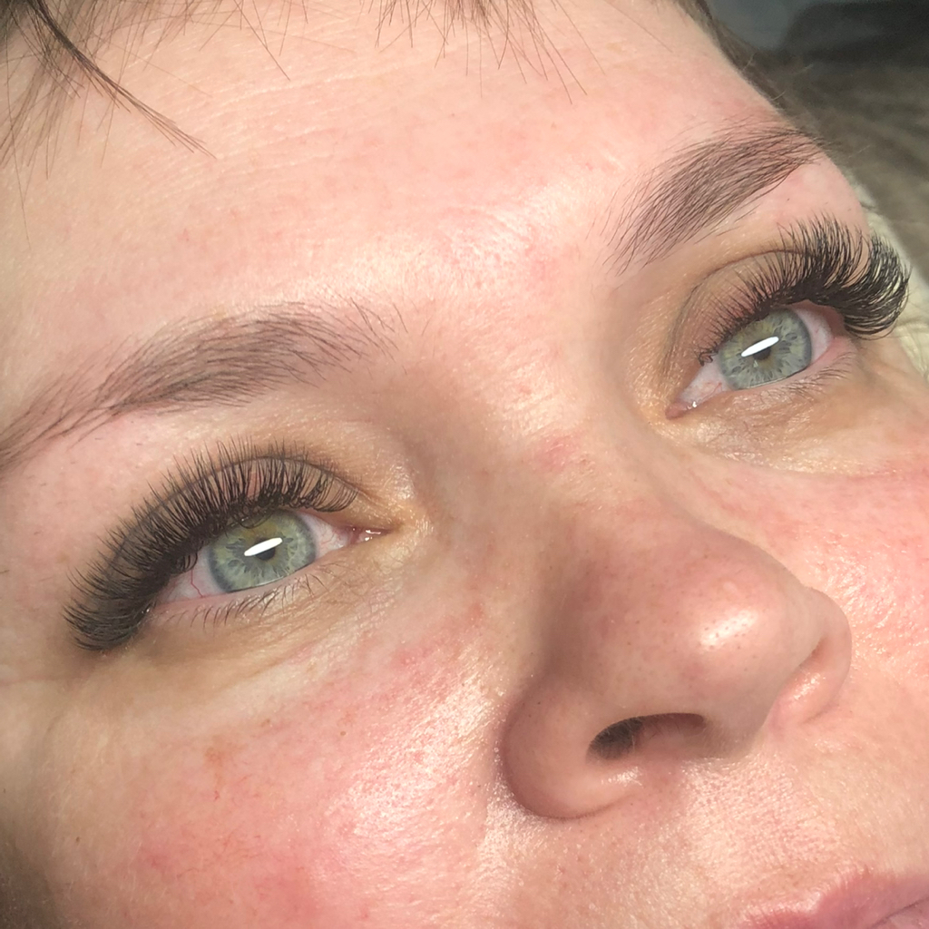 Двойной объем (2Д)