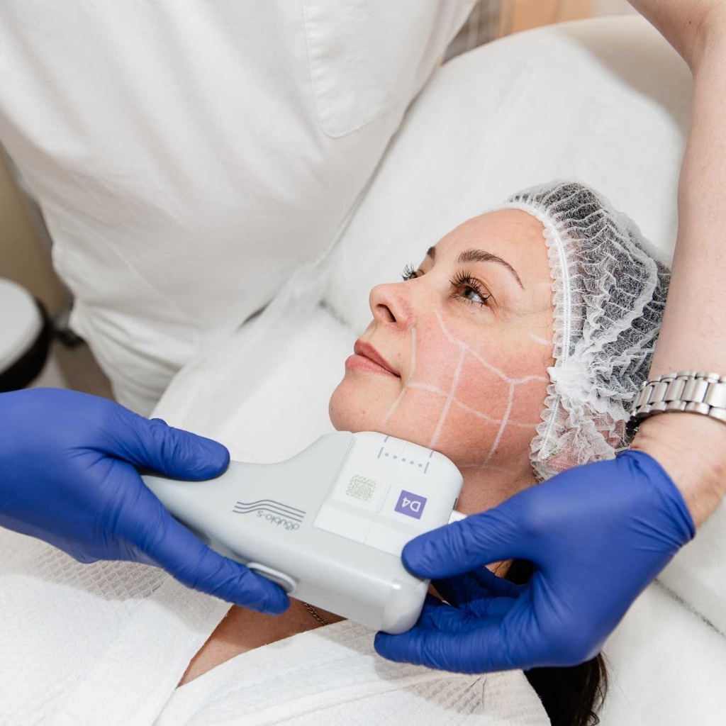 СМАС лифтинг