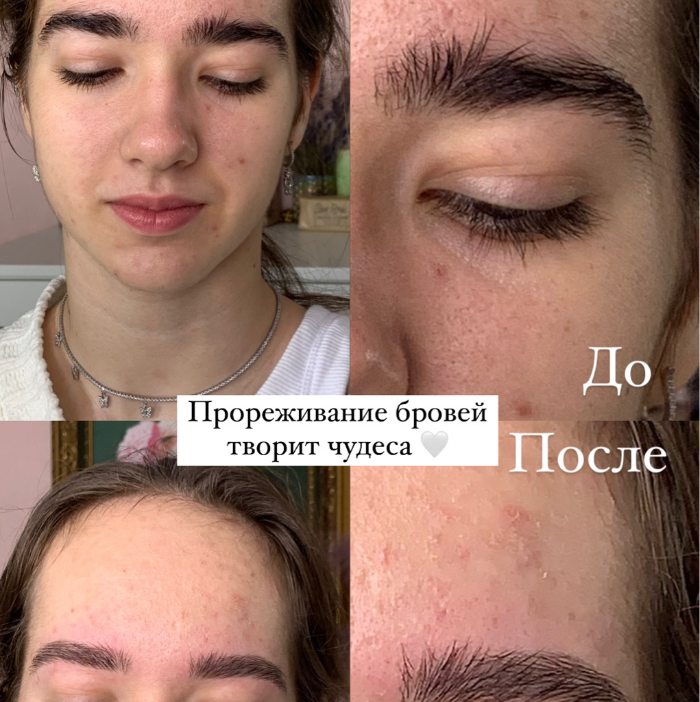 Прореживание бровей