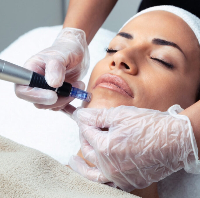 Фракционная мезотерапия лица