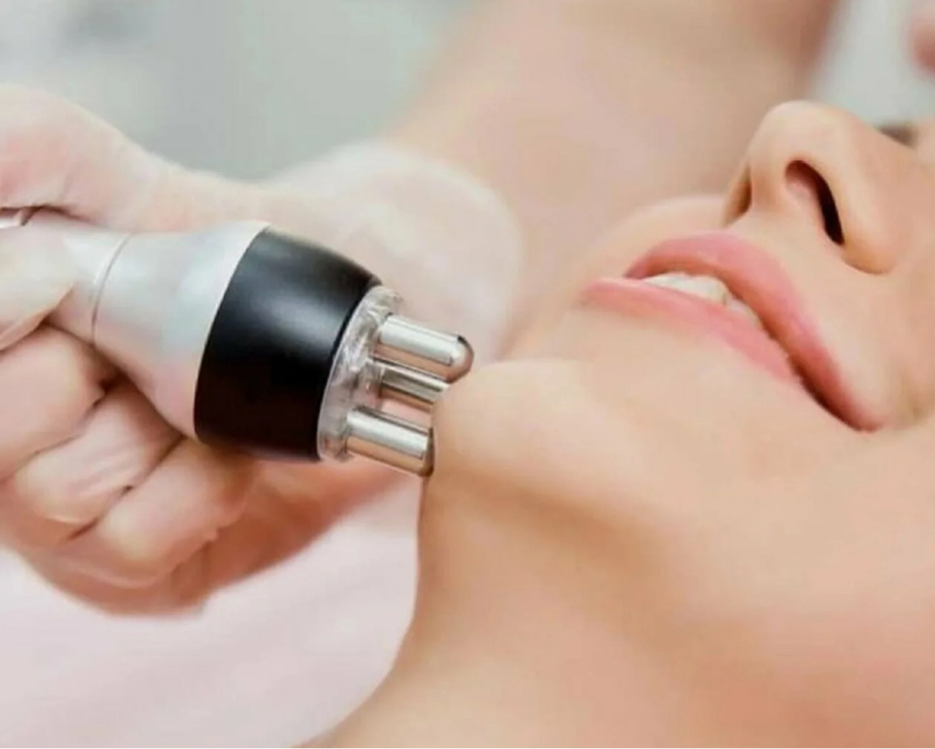 RF-лифтинг лица ( 1100р при покупки абонемента 5/10 процедур, разово 1400р)