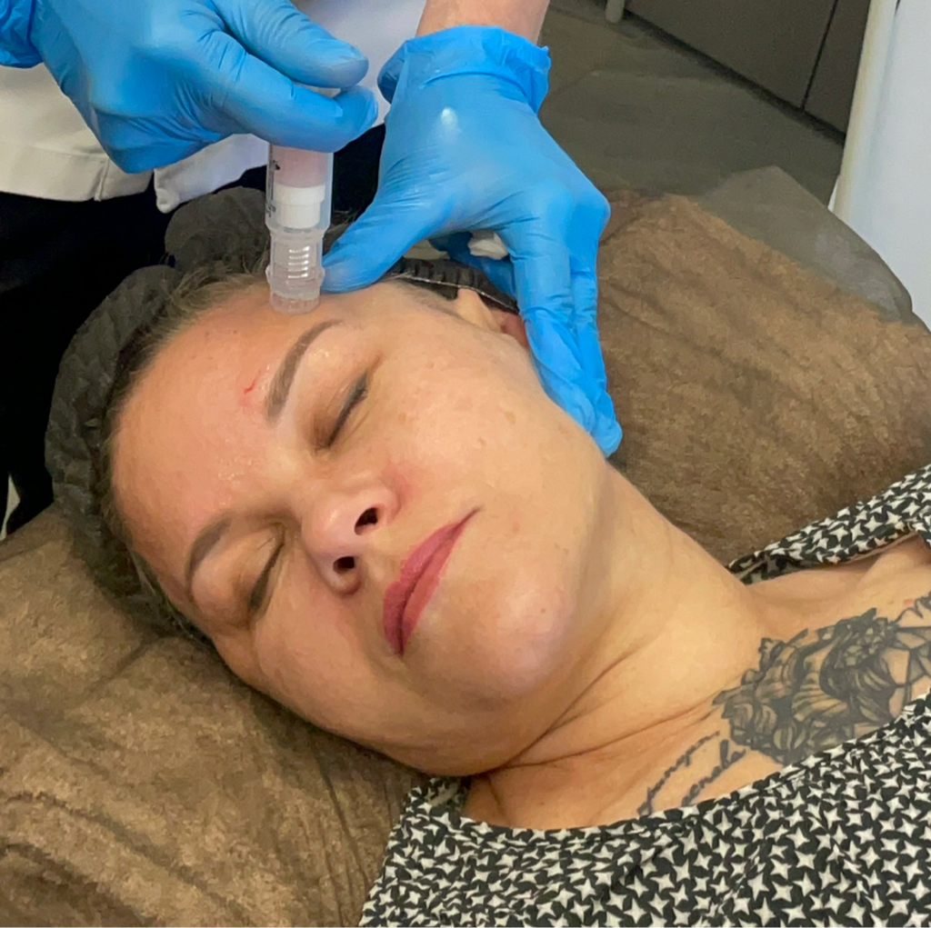 Мезотерапия омолаживающая с комплексом витаминов, аминокислот и антиоксидантов DEEP SHOOT (Испания) + чистка ультразвуковая + пилинг обновляющий