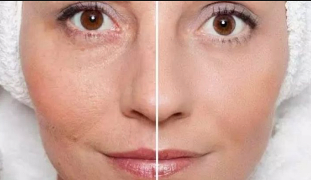 Пилинг лица  «Ретиноловый»