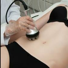 RF лифтинг тело