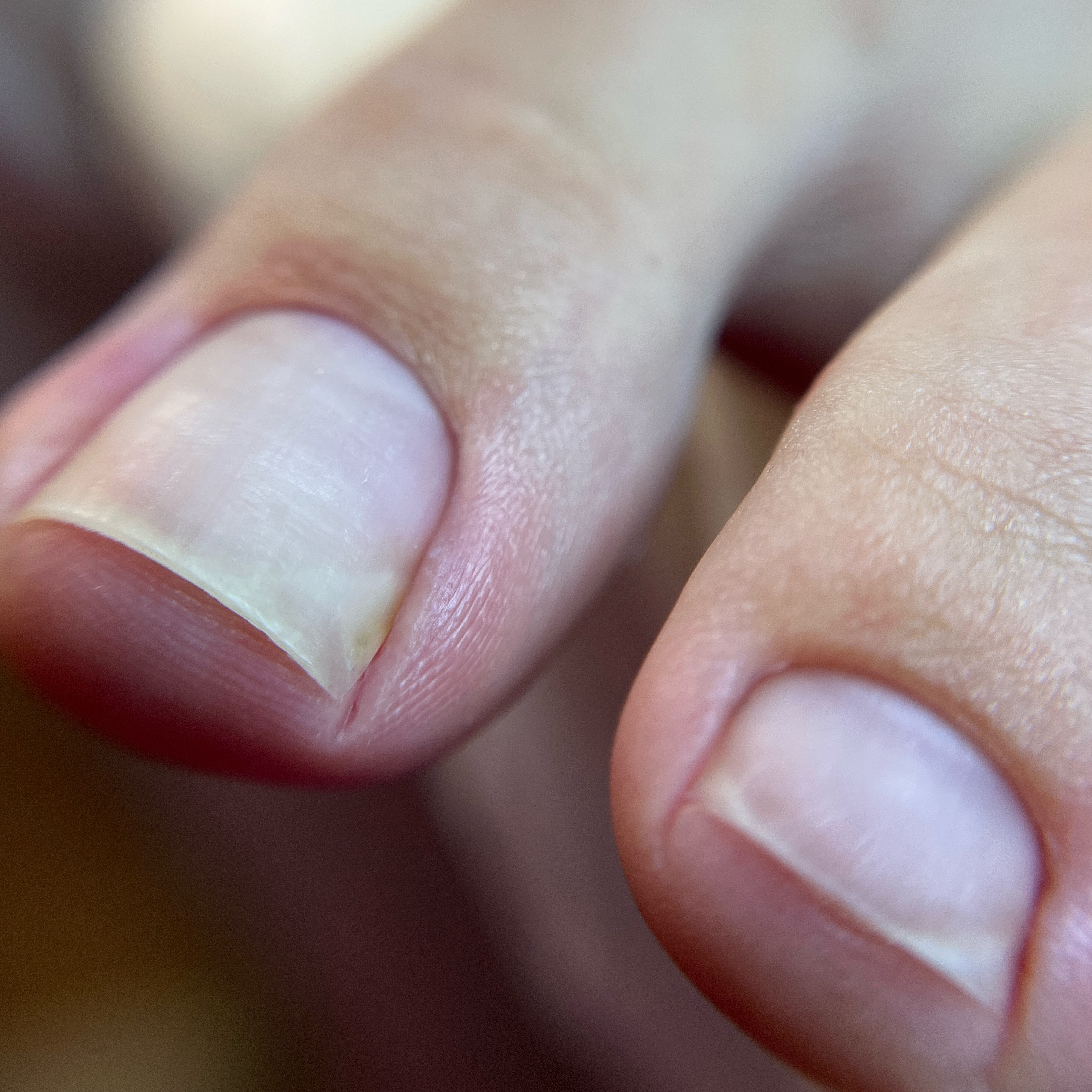 Экспресс педикюр