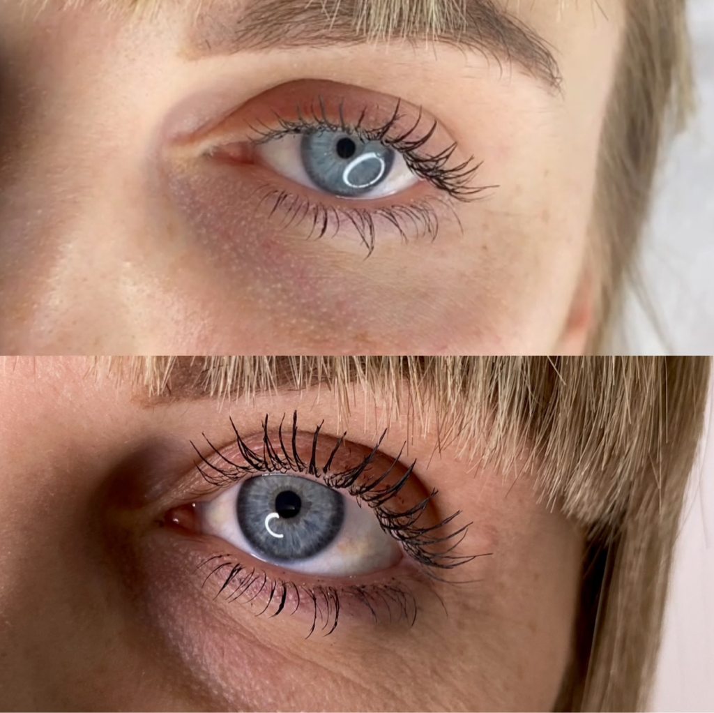 Носослезная борозда