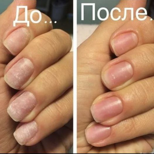 Система IBX