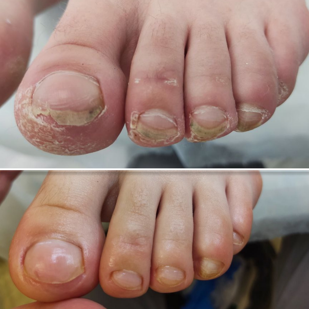 Подростковый педикюр, детский ( возраст до 16 лет )