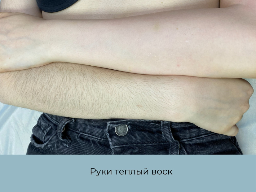 Руки полностью