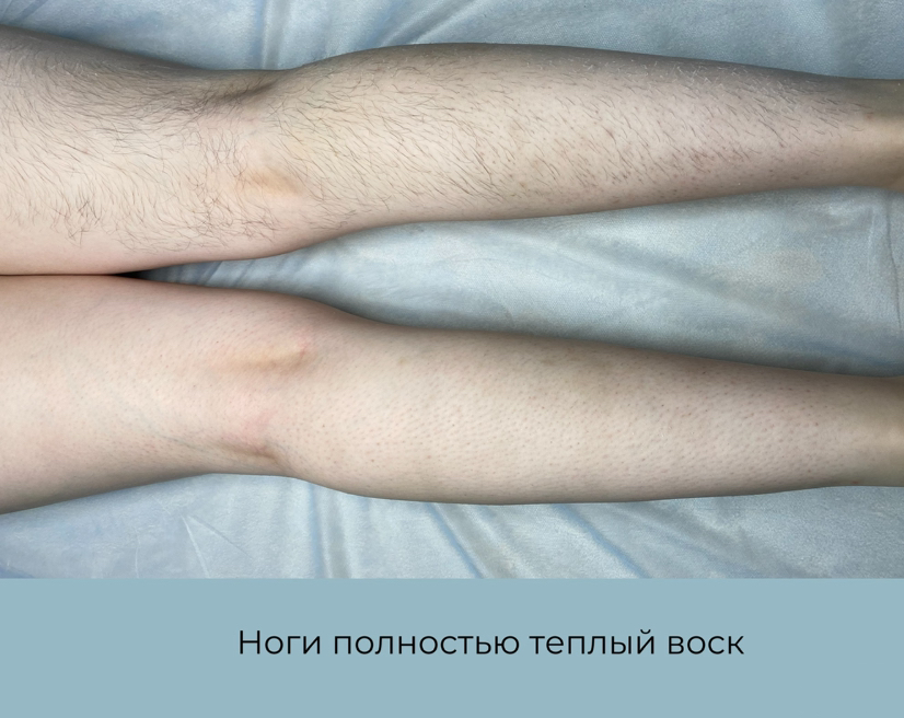 Ноги полностью