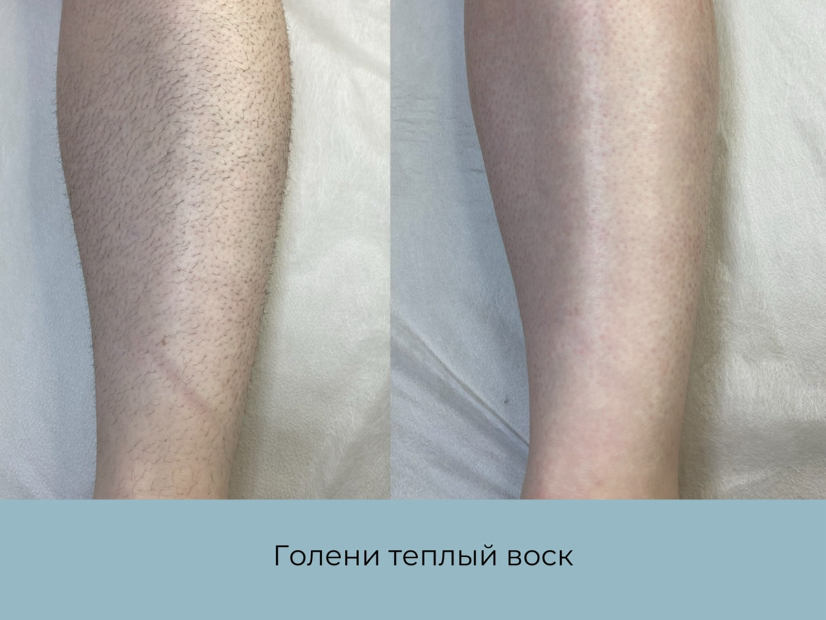 Голени + колено