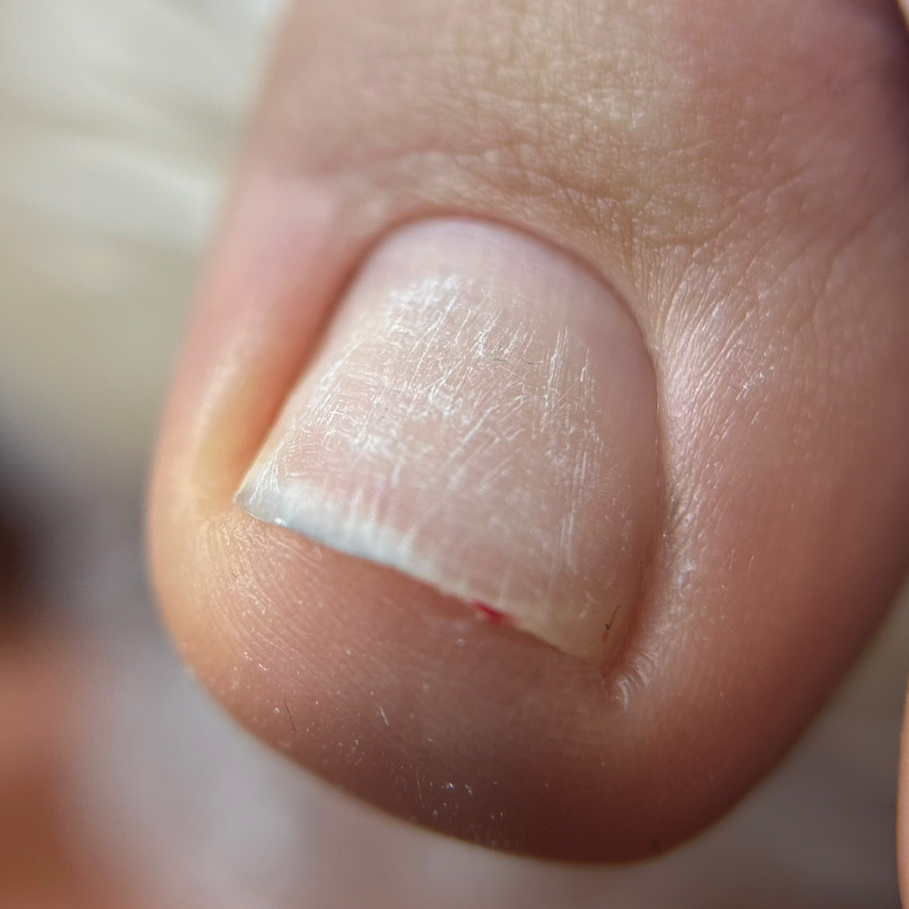 Педикюр гигиена