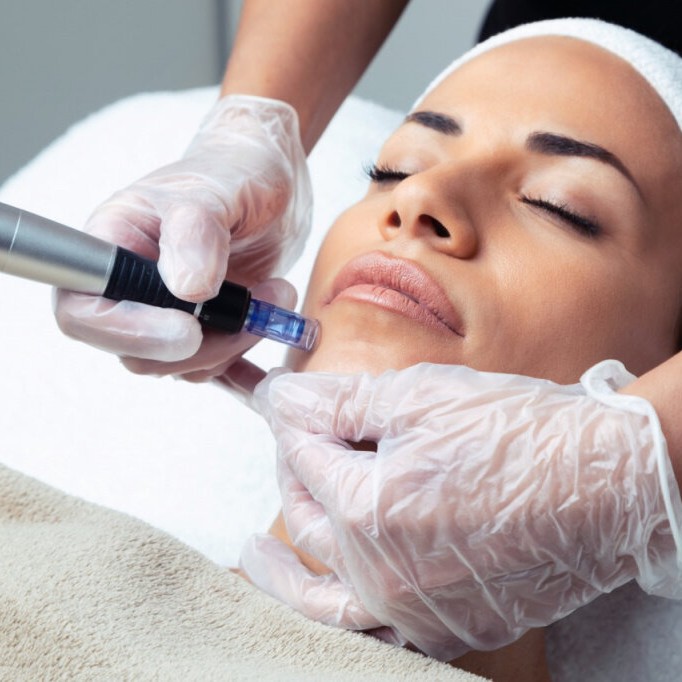 Фракционная (dermapen) мезотерапия кожи лица